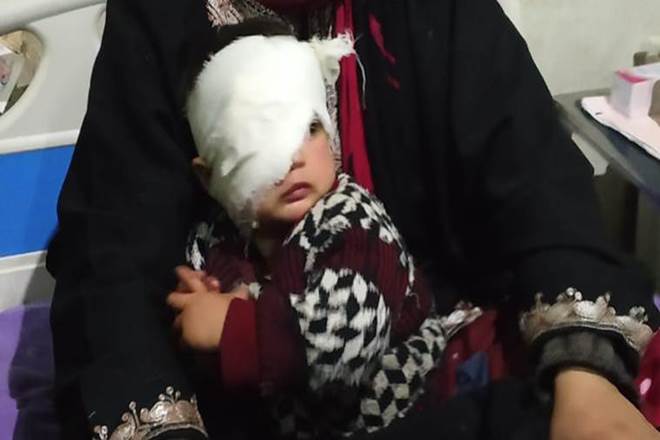 Kashmir based activists filed petition at NHRC against using of pellet on toddler